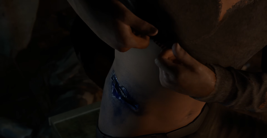 Hands pulling shirt up, revealing blue wound on abdomen